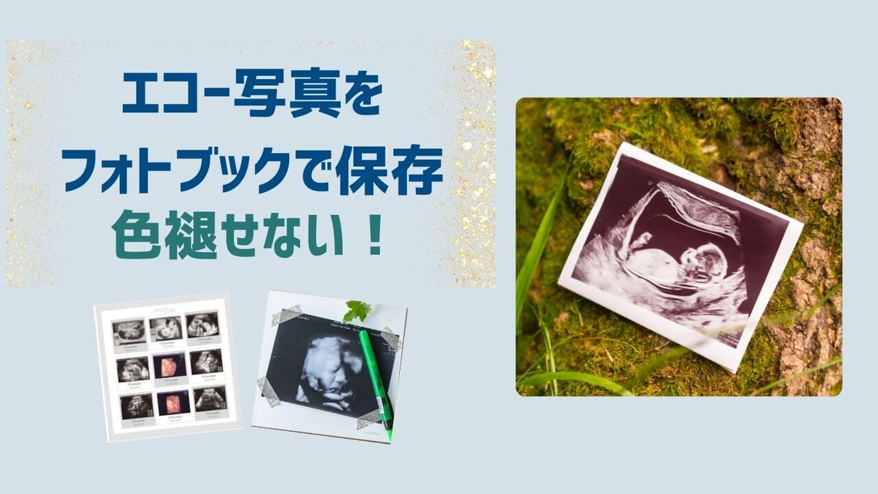 エコー写真をフォトブックで保存！色褪せない！